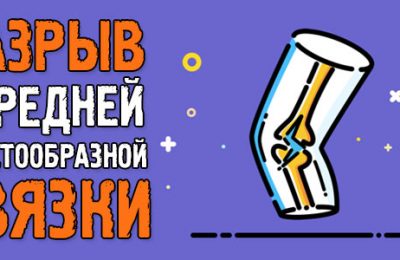 Разрыв передней крестообразной связки коленного сустава: операция и как я восстановился после этой травмы