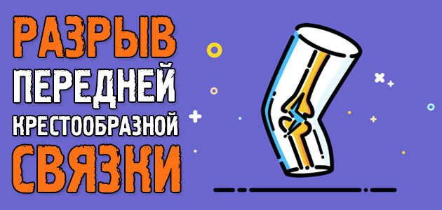 Разрыв передней крестообразной связки коленного сустава: операция и как я восстановился после этой травмы